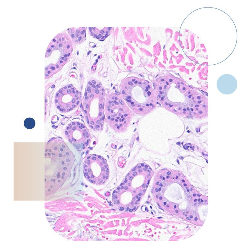 What Is Dermatopathology?