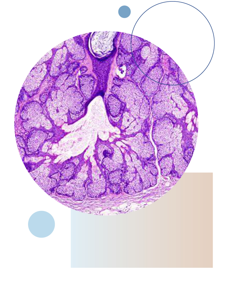 Dermatopathology | Pacific Dermatology Institute